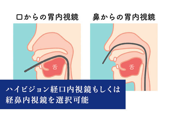 ハイビジョン経口内視鏡もしくは経鼻内視鏡を選択可能