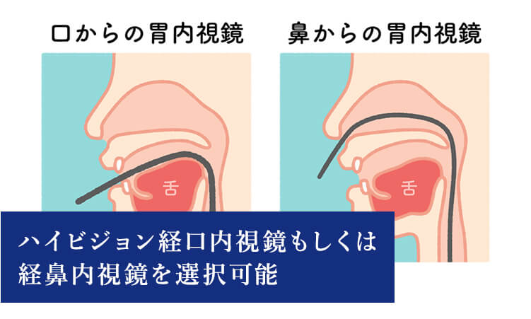 ハイビジョン経口内視鏡もしくは経鼻内視鏡を選択可能