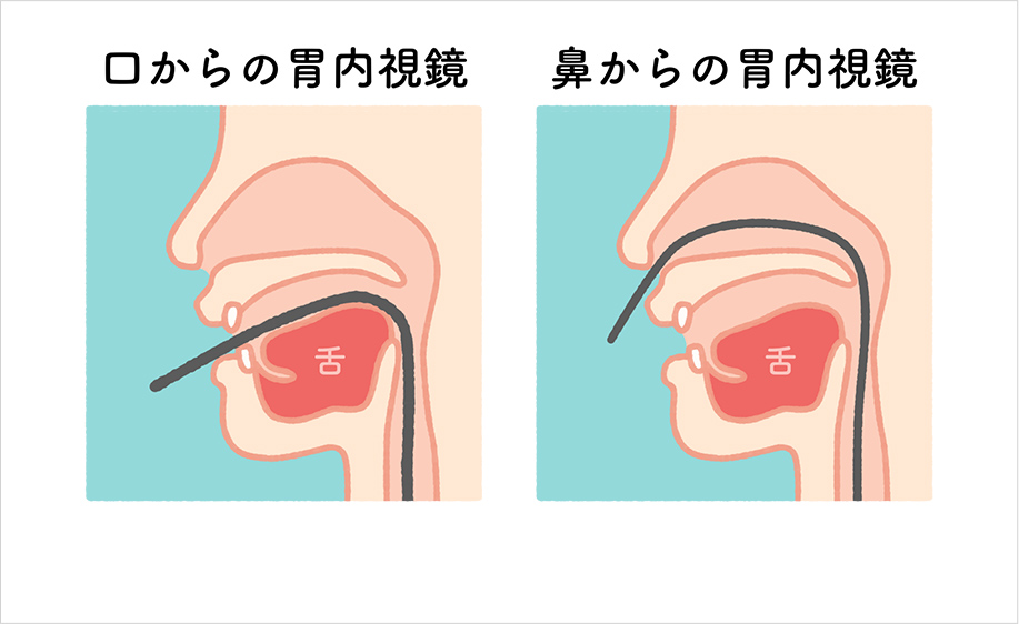 ハイビジョン経口内視鏡もしくは経鼻内視鏡が選べます