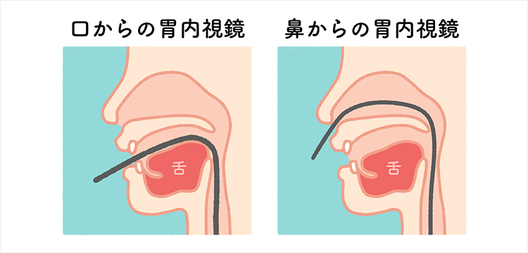 ハイビジョン経口内視鏡もしくは経鼻内視鏡が選べます